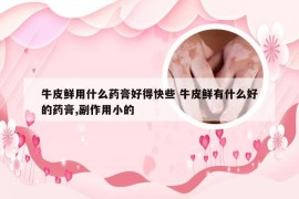 牛皮鲜用什么药膏好得快些 牛皮鲜有什么好的药膏,副作用小的
