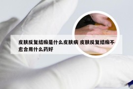 皮肤反复结痂是什么皮肤病 皮肤反复结痂不愈合用什么药好