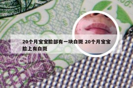20个月宝宝脸部有一块白斑 20个月宝宝脸上有白斑
