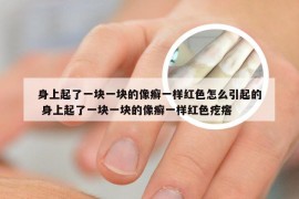 身上起了一块一块的像癣一样红色怎么引起的 身上起了一块一块的像癣一样红色疙瘩
