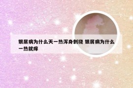 银屑病为什么天一热浑身刺挠 银屑病为什么一热就痒