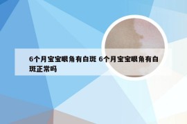 6个月宝宝眼角有白斑 6个月宝宝眼角有白斑正常吗
