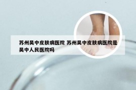 苏州吴中皮肤病医院 苏州吴中皮肤病医院是吴中人民医院吗