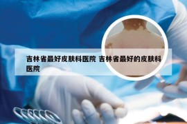 吉林省最好皮肤科医院 吉林省最好的皮肤科医院