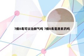 7癣8毒可以治脚气吗 7癣8毒是激素药吗