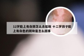 12岁脸上有白斑怎么去能除 十二岁孩子脸上有白色的斑块是怎么回事