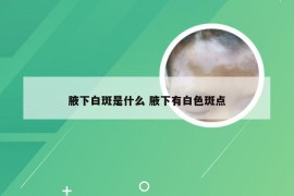 腋下白斑是什么 腋下有白色斑点