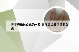 鼻子旁边长白色的一片 鼻子旁边起了很多白点