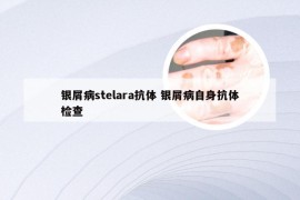银屑病stelara抗体 银屑病自身抗体检查
