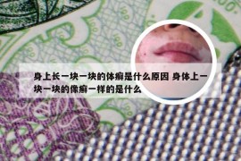 身上长一块一块的体癣是什么原因 身体上一块一块的像癣一样的是什么