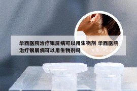 华西医院治疗银屑病可以用生物剂 华西医院治疗银屑病可以用生物剂吗