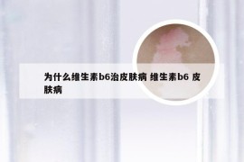 为什么维生素b6治皮肤病 维生素b6 皮肤病