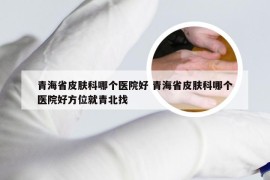 青海省皮肤科哪个医院好 青海省皮肤科哪个医院好方位就青北找