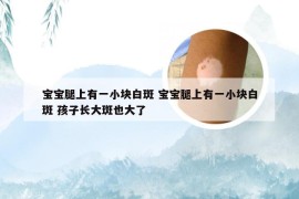 宝宝腿上有一小块白斑 宝宝腿上有一小块白斑 孩子长大斑也大了