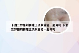 卡泊三醇搽剂和康王洗发露能一起用吗 卡泊三醇搽剂和康王洗发露能一起用吗