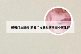 朝天门皮肤科 朝天门皮肤科医院哪个医生好