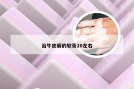治牛皮癣的软膏20左右