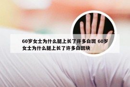 60岁女士为什么腿上长了许多白斑 60岁女士为什么腿上长了许多白斑块