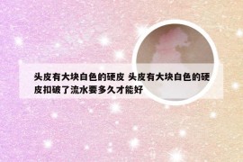 头皮有大块白色的硬皮 头皮有大块白色的硬皮扣破了流水要多久才能好