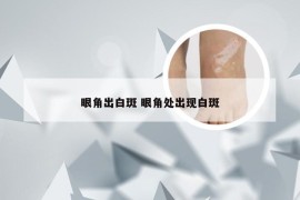 眼角出白斑 眼角处出现白斑