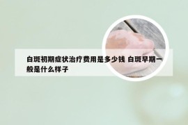 白斑初期症状治疗费用是多少钱 白斑早期一般是什么样子