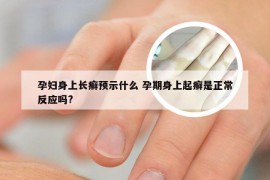 孕妇身上长癣预示什么 孕期身上起癣是正常反应吗?