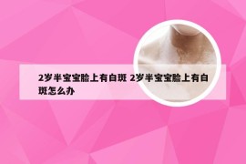 2岁半宝宝脸上有白斑 2岁半宝宝脸上有白斑怎么办