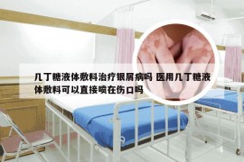 几丁糖液体敷料治疗银屑病吗 医用几丁糖液体敷料可以直接喷在伤口吗