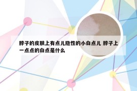 脖子的皮肤上有点儿隐性的小白点儿 脖子上一点点的白点是什么