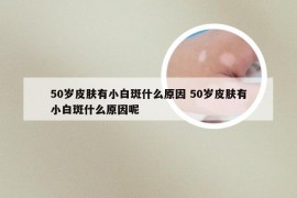 50岁皮肤有小白斑什么原因 50岁皮肤有小白斑什么原因呢