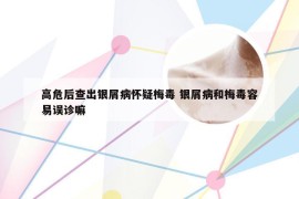 高危后查出银屑病怀疑梅毒 银屑病和梅毒容易误诊嘛