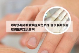 鄂尔多斯市皮肤病医院怎么样 鄂尔多斯市皮肤病医院怎么样啊