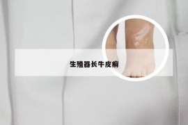 生殖器长牛皮癣