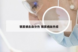 银屑病去血分热 银屑病血热症