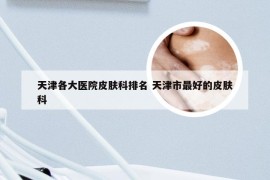 天津各大医院皮肤科排名 天津市最好的皮肤科