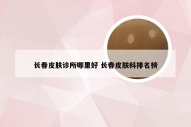 长春皮肤诊所哪里好 长春皮肤科排名榜