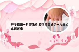 脖子后面一片好像癣 脖子后面长了一片癣的东西还痒