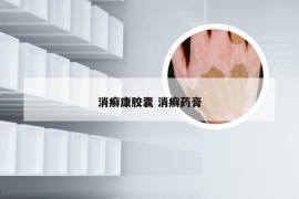 消癣康胶囊 消癣药膏