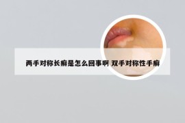 两手对称长癣是怎么回事啊 双手对称性手癣