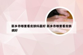 新乡市哪里看皮肤科最好 新乡市哪里看皮肤病好