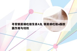 寻常银屑病吃维生素A丸 银屑病吃维a酸胶囊作用与功效