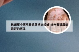 杭州那个医院看银屑病比较好 杭州看银屑病最好的医生