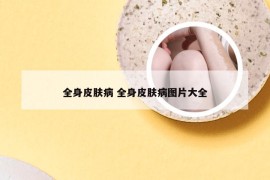 全身皮肤病 全身皮肤病图片大全