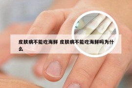 皮肤病不能吃海鲜 皮肤病不能吃海鲜吗为什么