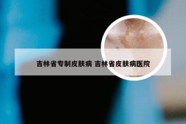 吉林省专制皮肤病 吉林省皮肤病医院