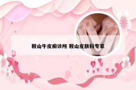鞍山牛皮癣诊所 鞍山皮肤科专家