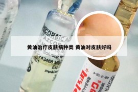 黄油治疗皮肤病种类 黄油对皮肤好吗