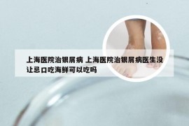 上海医院治银屑病 上海医院治银屑病医生没让忌口吃海鲜可以吃吗