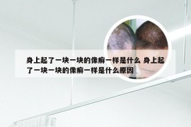 身上起了一块一块的像癣一样是什么 身上起了一块一块的像癣一样是什么原因