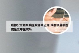 成都公立银屑病医院哪家正规 成都银屑病医院是三甲医院吗